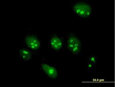 Immunocytochemistry/ Immunofluorescence: ABT1 Antibody [H00029777-B02P]