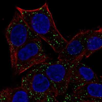 Immunocytochemistry/ Immunofluorescence: ABT1 Antibody [NBP2-69030]