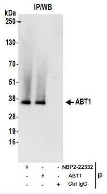 Immunoprecipitation: ABT1 Antibody [NBP2-22332]