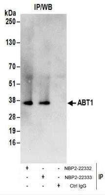 Immunoprecipitation: ABT1 Antibody [NBP2-22333]