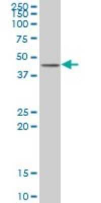 Western Blot: ABT1 Antibody [H00029777-B01P]