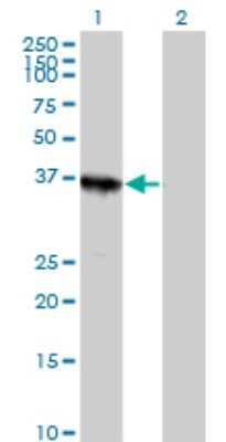 Western Blot: ABT1 Antibody [H00029777-B01P]