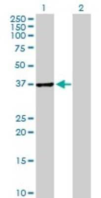 Western Blot: ABT1 Antibody [H00029777-B02P]