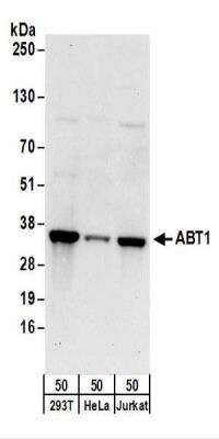 Western Blot: ABT1 Antibody [NBP2-22332]