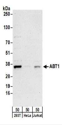 Western Blot: ABT1 Antibody [NBP2-22333]