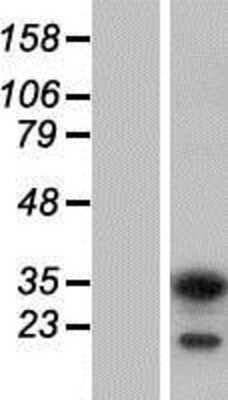 Western Blot: ABT1 Overexpression Lysate [NBP2-07414]