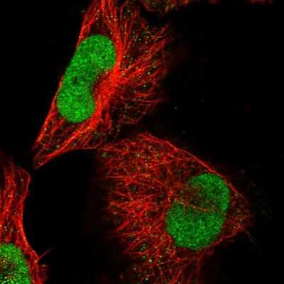 Immunocytochemistry/ Immunofluorescence: ABTB2 Antibody [NBP1-84141]