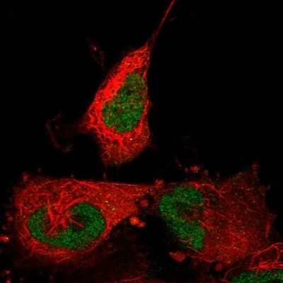 Immunocytochemistry/ Immunofluorescence: ABTB2 Antibody [NBP2-55198]