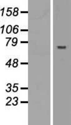 Western Blot: ABTB2 Overexpression Lysate [NBL1-07215]