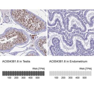 Immunohistochemistry-Paraffin: REXO5 Antibody [NBP1-92076]