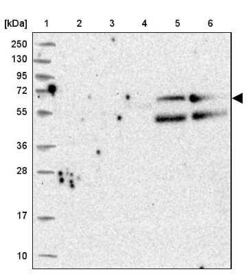 Western Blot: REXO5 Antibody [NBP1-92076]