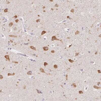 Immunohistochemistry-Paraffin: AC011484.2 Antibody [NBP2-58266]