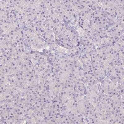 Immunohistochemistry-Paraffin: AC011484.2 Antibody [NBP2-58266]