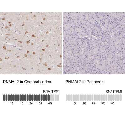 Immunohistochemistry-Paraffin: AC011484.2 Antibody [NBP2-58266]