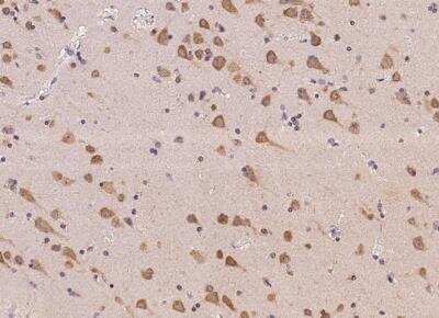 Immunohistochemistry-Paraffin: AC011484.2 Antibody [NBP3-06547]
