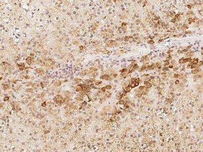 Immunohistochemistry-Paraffin: AC011484.2 Antibody [NBP3-06547]