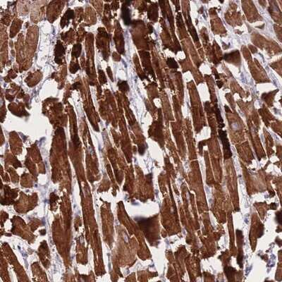 Immunohistochemistry-Paraffin: CTBP2 Antibody [NBP2-14541]