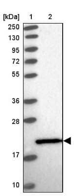 Western Blot: CTBP2 Antibody [NBP2-14541]