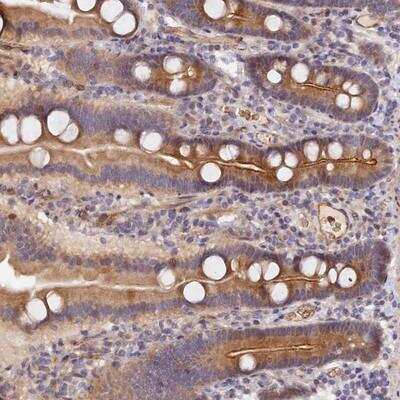 Immunohistochemistry: MISP3 Antibody [NBP1-91122]