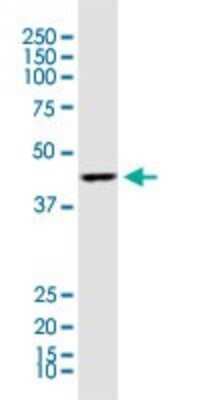 Western Blot: ACAA1 Antibody (3F11) [H00000030-M01]