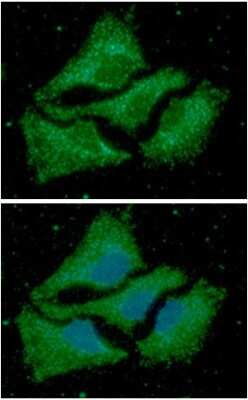 Immunocytochemistry/ Immunofluorescence: ACAA1 Antibody (9E5) - BSA Free [NBP2-59467]