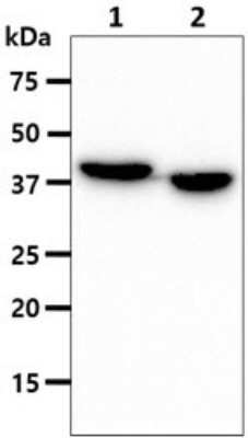 Western Blot: ACAA1 Antibody (9E5)BSA Free [NBP2-59467]