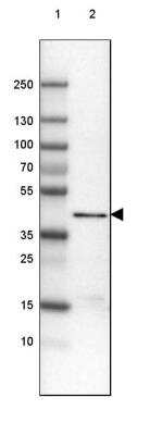 Western Blot: ACAA1 Antibody (CL2650) [NBP2-42380]