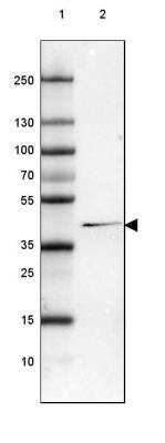 Western Blot: ACAA1 Antibody (CL2660) [NBP2-42383]