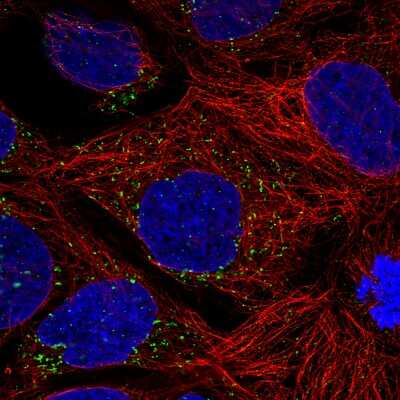 Immunocytochemistry/ Immunofluorescence: ACAA1 Antibody (CL2662) [NBP2-42381]