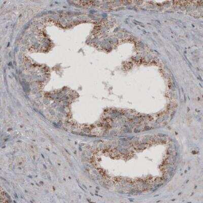 Immunohistochemistry: ACAA1 Antibody (CL2662) [NBP2-42381]