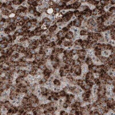 Immunohistochemistry: ACAA1 Antibody (CL2662) [NBP2-42381]