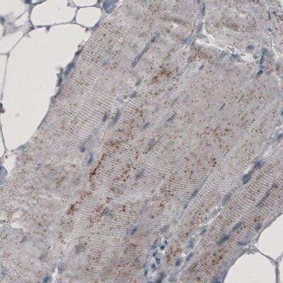 Immunohistochemistry: ACAA1 Antibody (CL2662) [NBP2-42381]