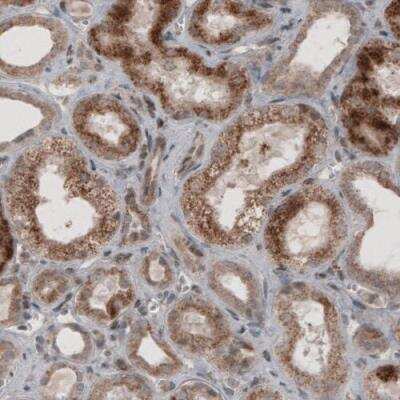 Immunohistochemistry: ACAA1 Antibody (CL2662) [NBP2-42381]