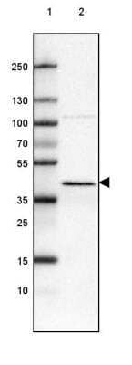 Western Blot: ACAA1 Antibody (CL2662) [NBP2-42381]