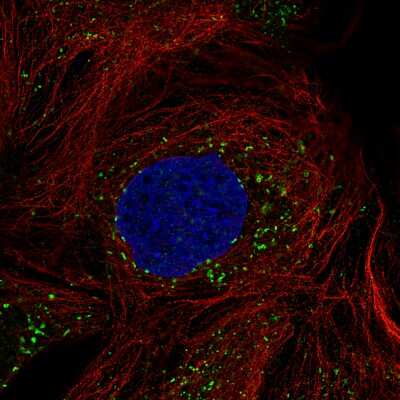 Immunocytochemistry/ Immunofluorescence: ACAA1 Antibody (CL2663) [NBP2-42382]