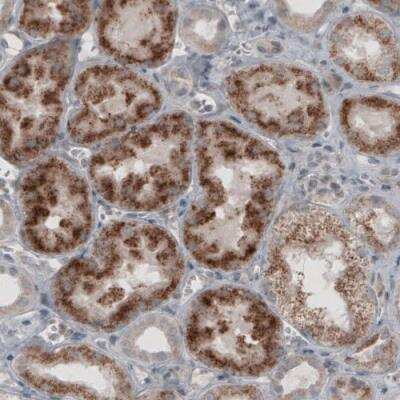 Immunohistochemistry: ACAA1 Antibody (CL2663) [NBP2-42382]