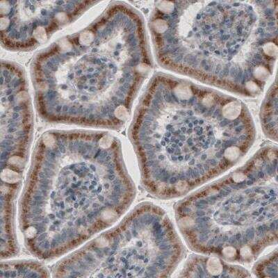 Immunohistochemistry: ACAA1 Antibody (CL2663) [NBP2-42382]