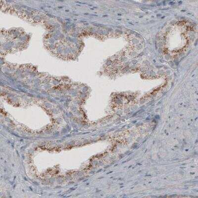 Immunohistochemistry: ACAA1 Antibody (CL2663) [NBP2-42382]