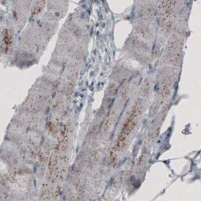 Immunohistochemistry: ACAA1 Antibody (CL2663) [NBP2-42382]