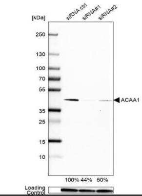 Western Blot: ACAA1 Antibody (CL2663) [NBP2-42382]