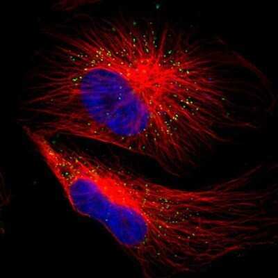 Immunocytochemistry/ Immunofluorescence: ACAA1 Antibody [NBP1-85786]
