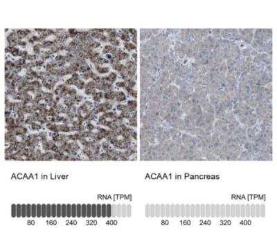 Immunohistochemistry-Paraffin: ACAA1 Antibody [NBP1-85786]