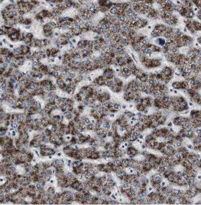Immunohistochemistry-Paraffin: ACAA1 Antibody [NBP1-85786]