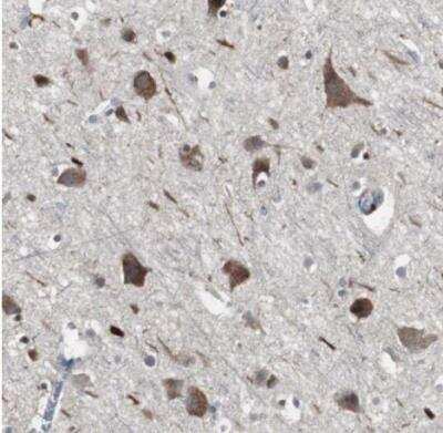 Immunohistochemistry-Paraffin: ACAA1 Antibody [NBP1-85786]