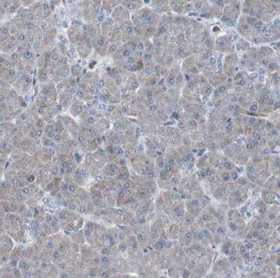 Immunohistochemistry-Paraffin: ACAA1 Antibody [NBP1-85786]