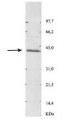 Western Blot: ACAA1 Antibody [NBP1-55156]