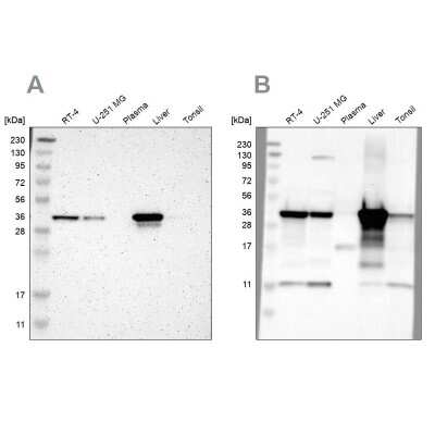 Western Blot: ACAA1 Antibody [NBP1-86128]