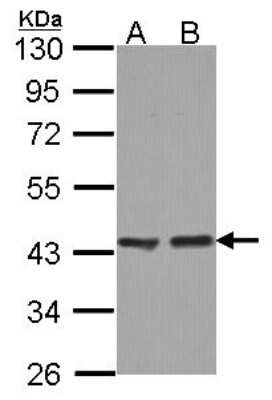 Western Blot: ACAA1 Antibody [NBP2-15233]