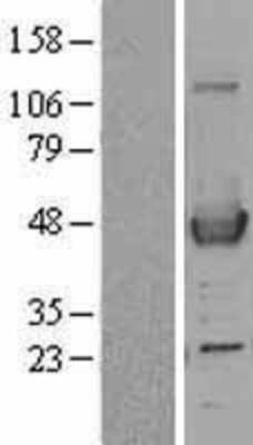 Western Blot: ACAA1 Overexpression Lysate [NBL1-07216]