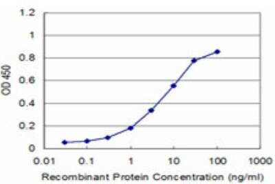 ELISA: ACAA2 Antibody (2F7) [H00010449-M05]